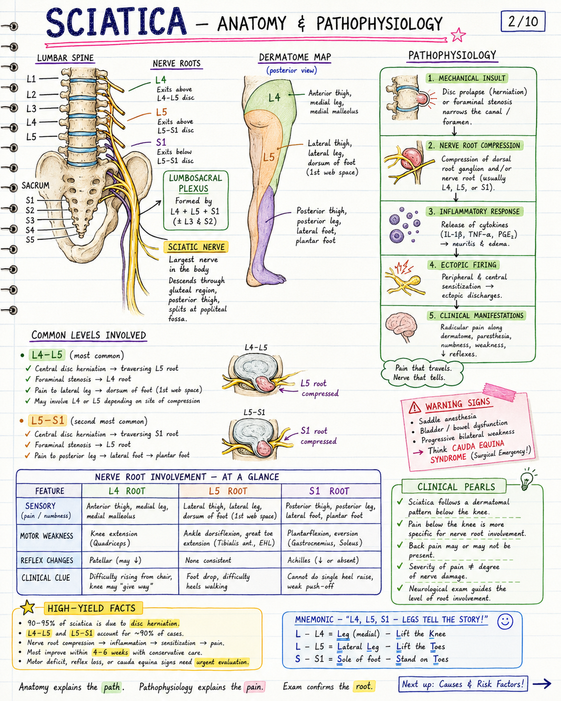 Sciatica handwritten notes image 2